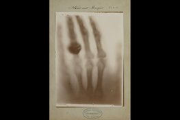 Oudste röntgenfoto&#39;s ter wereld gevonden in collectie Teylers Museum