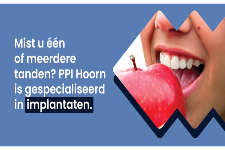 Mist u één of meerdere tanden?